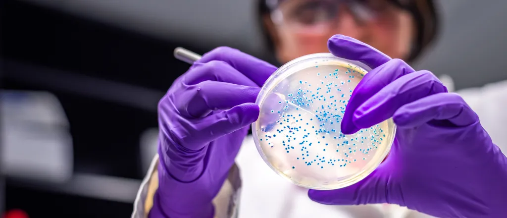 PROMO HIRES Health - Disease Health E. Coli Bacteria Germs - Manjurul - iStock-1131003688 Person wearing gloves and eye protection examines a laboratory specimen dish