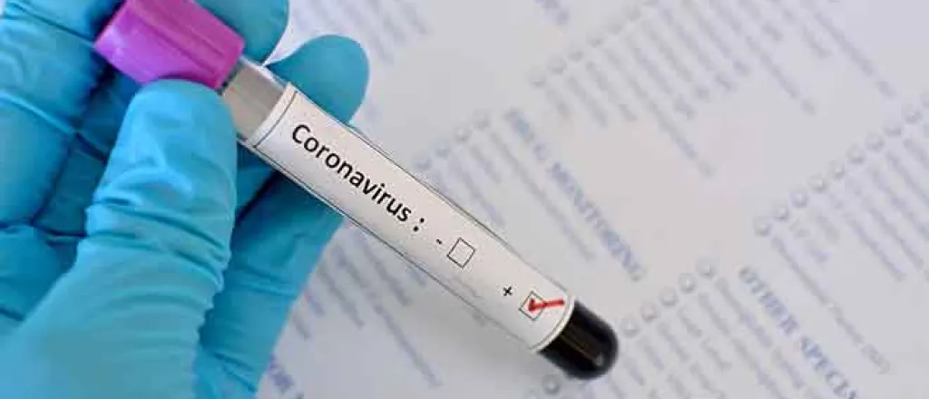PROMO 64J1 Health - 2019 Coronaviruse 2019-nCor China Outbreak Pandemic - iStock - jarun011 PROMO Health - 2019 Coronaviruse 2019-nCor China Outbreak Pandemic - iStock - jarun011