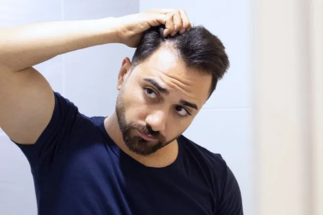 A man worriedly looking at himself in a mirror. He is pulling back his hairline to inspect for potential hair loss.